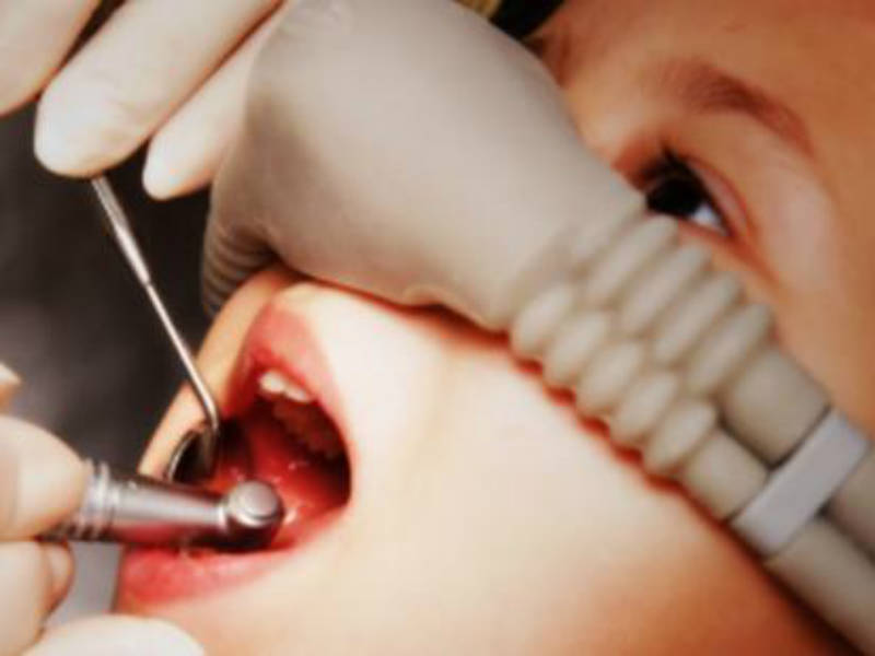 Sedazione cosciente per un’operazione odontoiatrica senza dolore