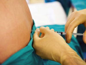 Epidurale