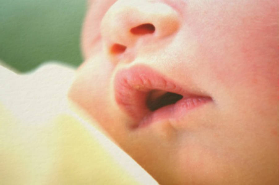 Russare e respirare con la bocca aperta: perché serve il dentista?