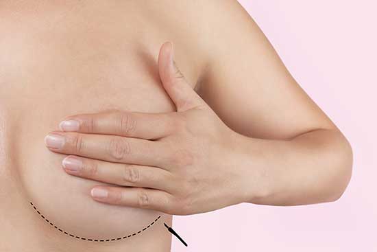 Prevenzione cancro e mastectomia: senza seno saremo sane?