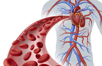 Lavaggio selettivo del sangue