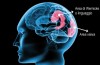 Ictus: lesione cerebrale a causa di un vaso sanguigno occluso