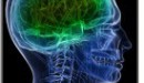 Test del Dna per individuare il cancro al colon