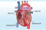 Filbrillazione atriale e ventricolare