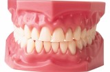 Protesi dentarie: sostituzione di uno o più denti con denti artificiali