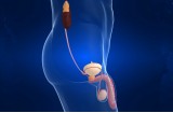 Urologia