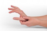 Artrite psoriasica: malattia reumatica infiammatoria