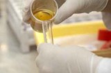 Urine