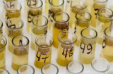 Urine
