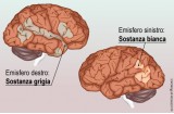 Encefalo