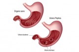 Osservazione dello stomaco
