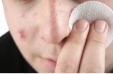Impacchi disinfettanti