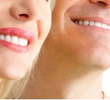 Lo sbiancamento dei denti per illuminare il sorriso