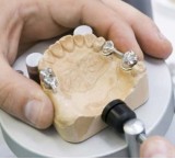 Con l'implantologia dentale la masticazione diventa efficace