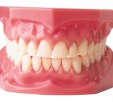 Protesi dentarie: sostituzione di uno o più denti con denti artificiali