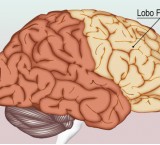 Sintomi del tumore al cervello, benigno e maligno