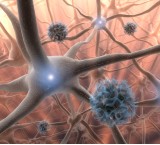 Neurologia cura il sistema nervoso
