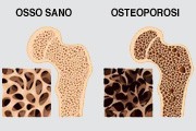 Osteoporosi