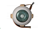 GLAUCOMA