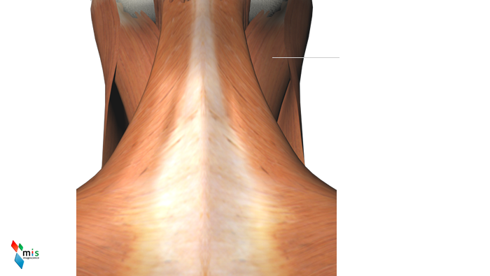 Muscolo Semispinale della Testa - apparato muscolare