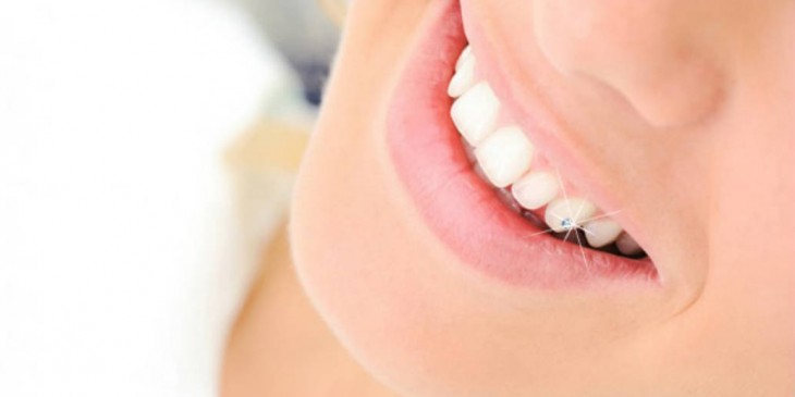 🦷Brillantino al dente: rischi e consigli ✨ ❗Il #brillantino, chiamato  anche cristallino dentale, è un piccolo #cristallo che viene applicato  sulla, By HDental