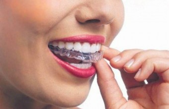 Malocclusione e bite