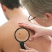Controllo dermatologico dei nei