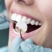 Visita odontoiatrica per prevenire i tumori