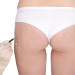 Gluteoplastica