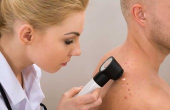 Melanoma, controllo dei nei