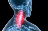 Polimialgia reumatica: malattia reumatica che si manifesta soprattutto con dolore muscolare al collo