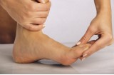 Alluce valgo: deformazione del primo dito del piede