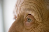 Morbo di Parkinson: malattia progressiva e invalidante del sistema nervoso extrapiramidale