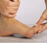 Alluce valgo: deformazione del primo dito del piede