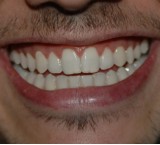 Ortodonzia: ramo dell'odontoiatria che corregge eventuali anomalie nello sviluppo dei denti